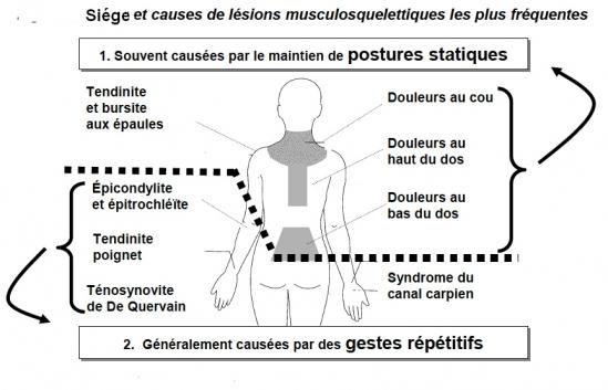 Causes lesion musculosqueletique 1