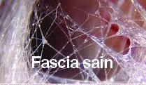Fascia souple 1